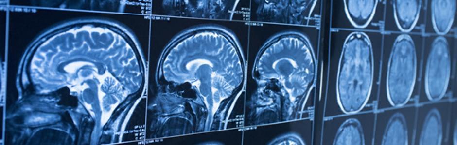 neurological header image